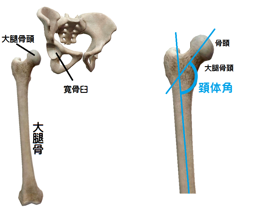 骨盤と頚体角の位置関係